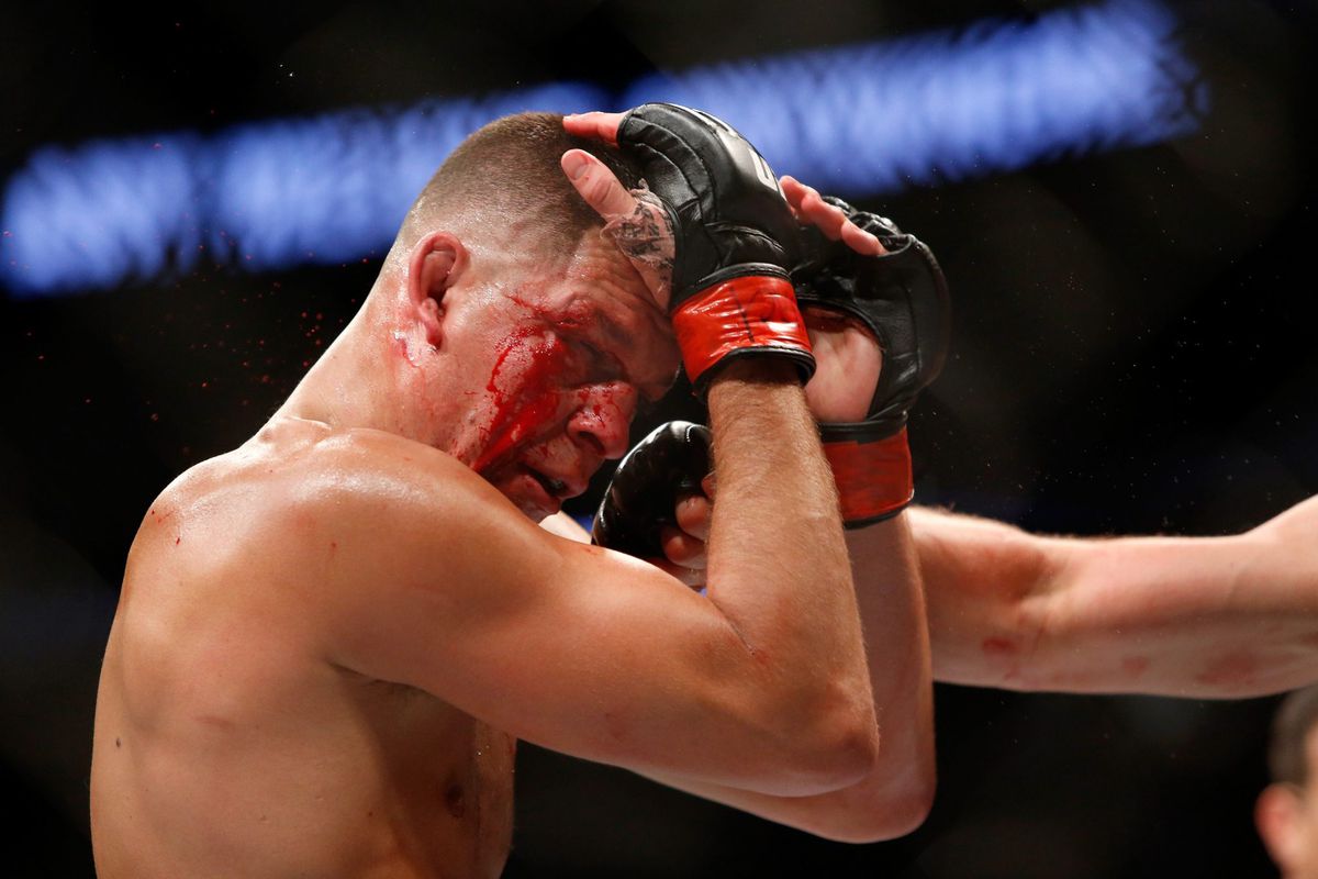 MMA-vechter Nate Diaz keert 2 jaar na 'McGregor-fight' weer terug in de kooi