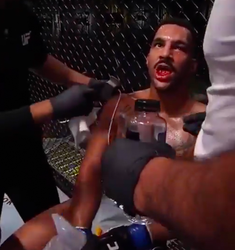🎥 | De tandjes! UFC'er Ion Cutelaba slaat gebit van tegenstander volledig aan gort