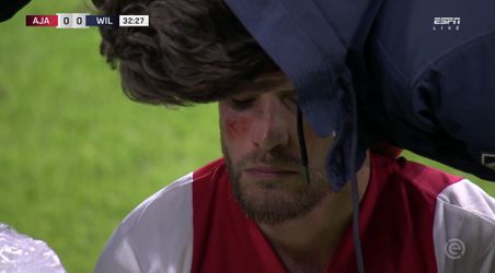 📸 | Nicolás Tagliafico raakte tegen Willem II alwéér GEWOND aan zijn hoofd