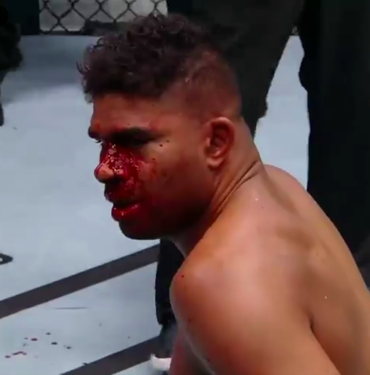 🥊🎥 | Alexander Volkov beukt bloedende Alistair Overeem in 2e ronde KEIHARD neer