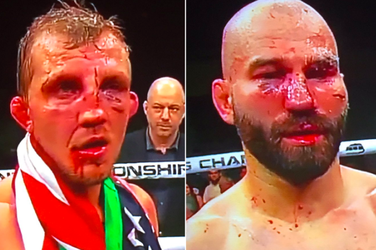 Check dit: Artem Lobov en Jason Knight slopen elkaar tijdens 'blote vuisten'-event (video's)