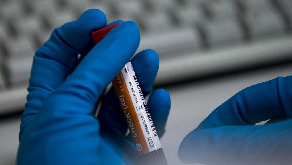 WADA geeft dopinglab uit Peking licentie terug