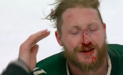 🎥 | WOW! NHL'er verlaat ijs met bebloed gezicht na intense knokpartij