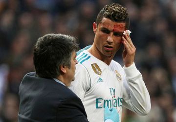 IJdeltuit Ronaldo kreeg 3 hechtingen: 'Ben nog steeds knap, dus er is geen probleem'