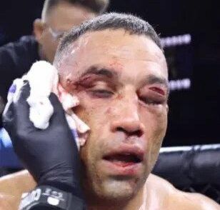 🎥​| HOLY F! Metersbrede scheur in ooglid Fabricio Werdum na potje bare knuckle