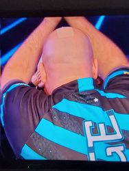 Waarom heeft darter Rob Cross een grote pleister op zijn kale kop?