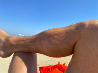 📸 | Benen Conor McGregor nog altijd kapot na mokertrappen Dustin Poirier
