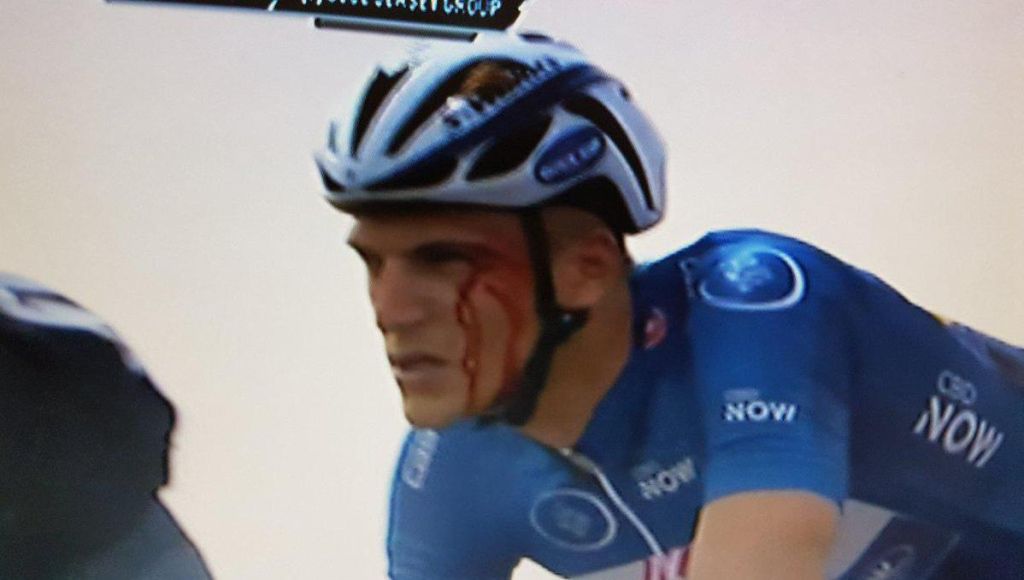 Bloed! Krijgt Kittel de 1e elleboogstoot in het wielrennen ooit?