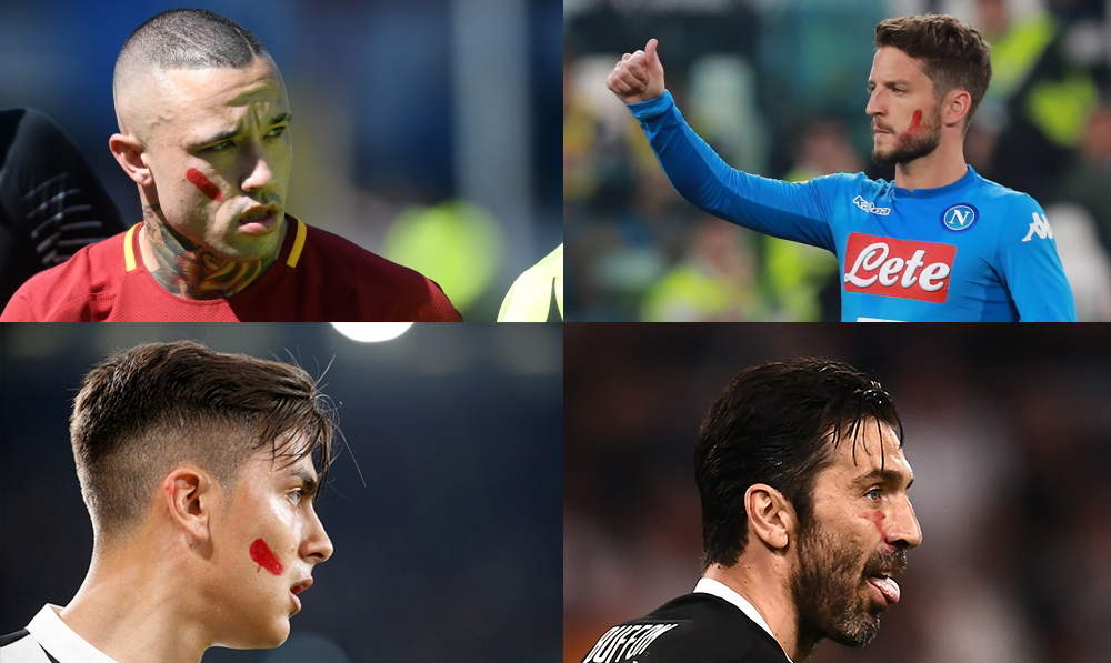 Dit was waarom spelers in de Serie A dit weekend rode vegen op hun gezicht hadden