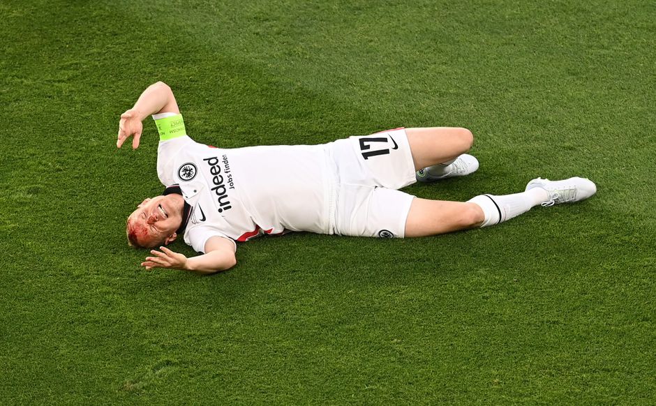 📸​ | Sebastian Rode ziet rood (bloed) na veel te hoog been van Rangers-speler Lundstram