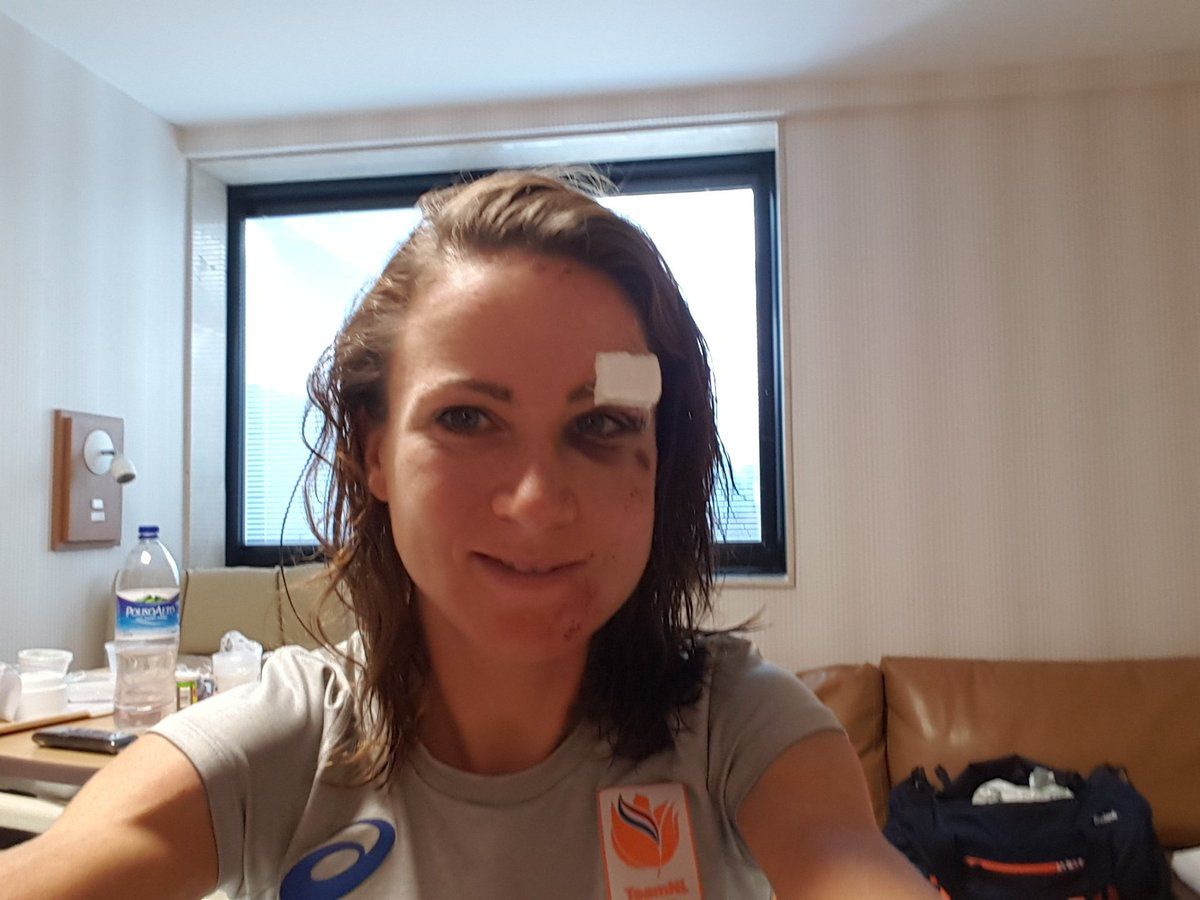 Annemiek van Vleuten deelt foto van haar gezicht