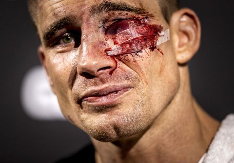 Rico Verhoeven gaat eerst acteren in Black Lotus, dan pas weer kickboksen