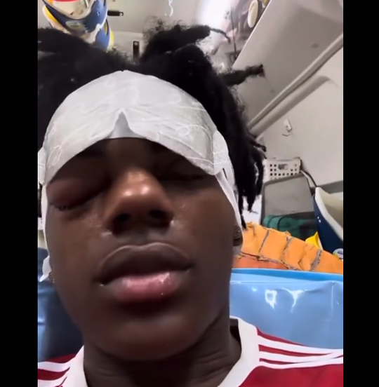 🎥😬 | IShowSpeed naar ziekenhuis met dik oog: 'Voelt alsof iemand mij steekt met mes'