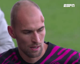 🎥🤕 | Gigantisch ei op voorhoofd FC Utrecht-spits Bas Dost na botsing met Go Ahead-speler