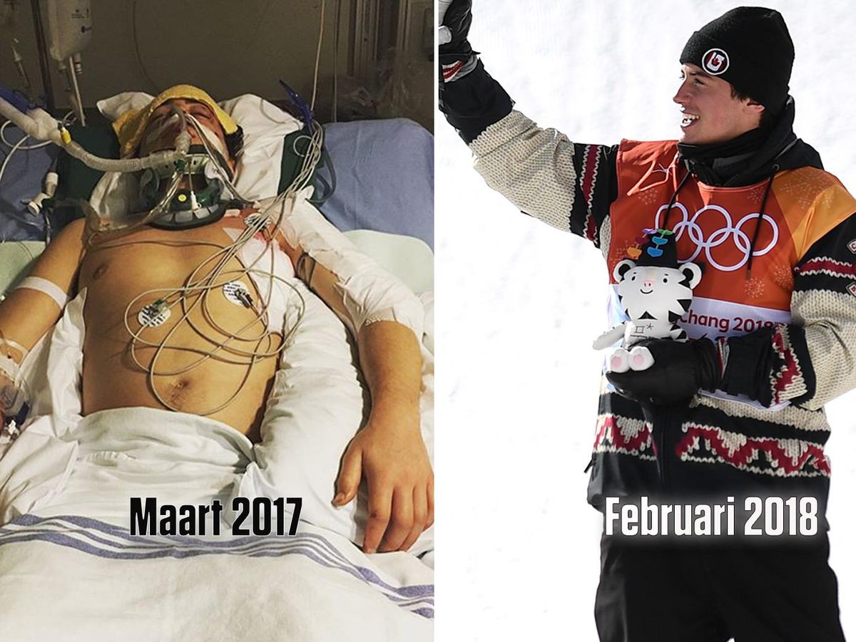 WOW! Canadese snowboarder vorig jaar bijna dood, maar pakt nu brons op de Spelen