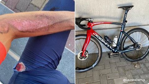 📸​ | Laurens De Plus showt wond na aanrijding: 'Wees voorzichtig met zwakke weggebruiker'