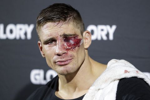 Nog even geduld! Wereldtitelgevecht tussen Verhoeven en Plazibat uitgesteld door blessure Rico