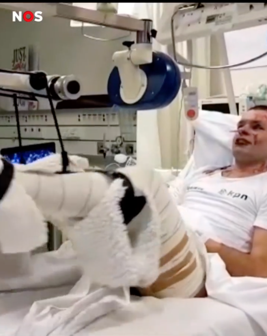 🎥 | Heftige beelden in documentaire Sjinkie Knegt na oplopen ernstige brandwonden