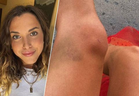 Zwemster die op feestje na WK zwemmen gedrogeerd werd, doet haar verhaal: 'Schaamte is wat ik voel'