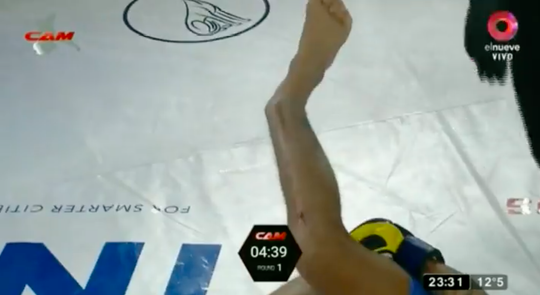 🎥 | Gruwelbeelden: MMA-vechter Pablo Rios breekt been na uitdelen van lowkick