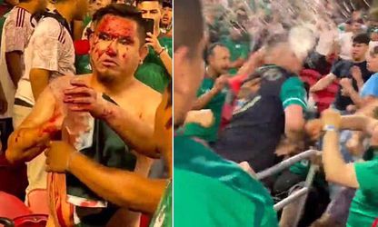 🎥 | Mexicaanse fan wordt bij Gold Cup met mes gestoken