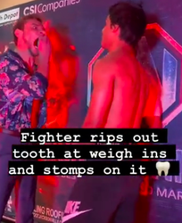 🎥 | MMA-man trekt eigen tand eruit bij staredown: 'Intimidatie van een ander niveau'