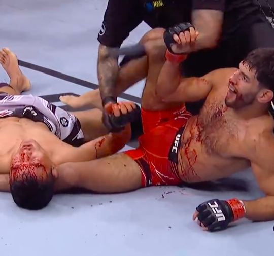 🎥 | UFC: kijk hier dé bloederige, beslissende ronde tussen Matt Schnell en Su Mudaerji