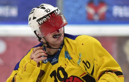 Knokpartij tussen ijshockeyers eindigt in bloedbad (video)