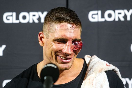 🎥 | Vet! Rico Verhoeven wil kickboksen én boksen tegen Tyson Fury