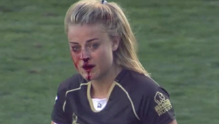 Video: Rugbyster breekt neus maar gaat gewoon door