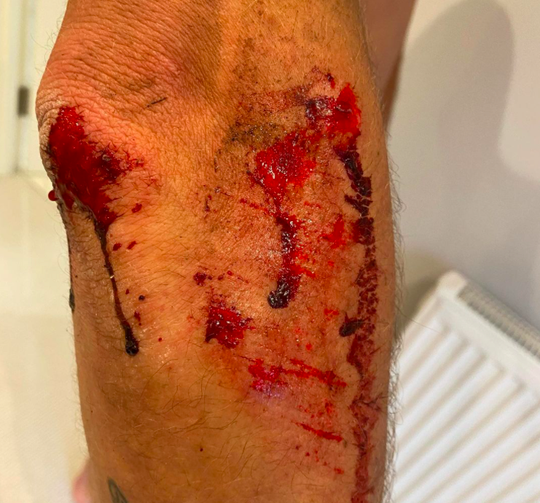 Profrenner overvallen door motorbende in Londens park: 'Trokken een machete'