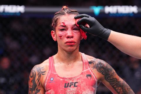 MMA-vechtster toont enorme schade aan gezicht na UFC-debuut: 'Ik ga geen excuses verzinnen'