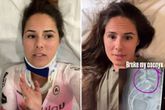 Geliefde ex-topschaatsster (33) krijgt pijnlijke diagnose na zware val: 'Blijf me liefde geven'