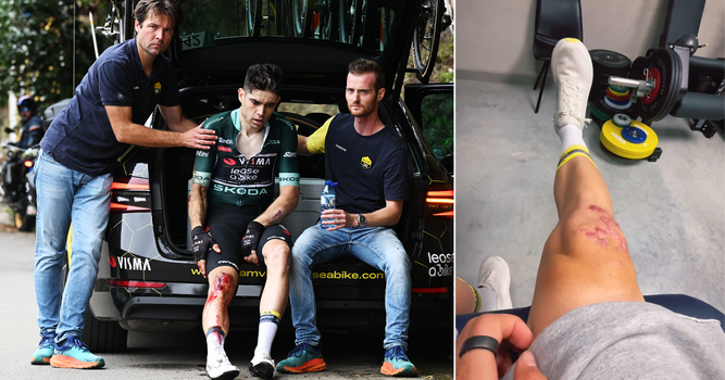 Wout van Aert toont akelige gevolgen van harde crash in Vuelta a España