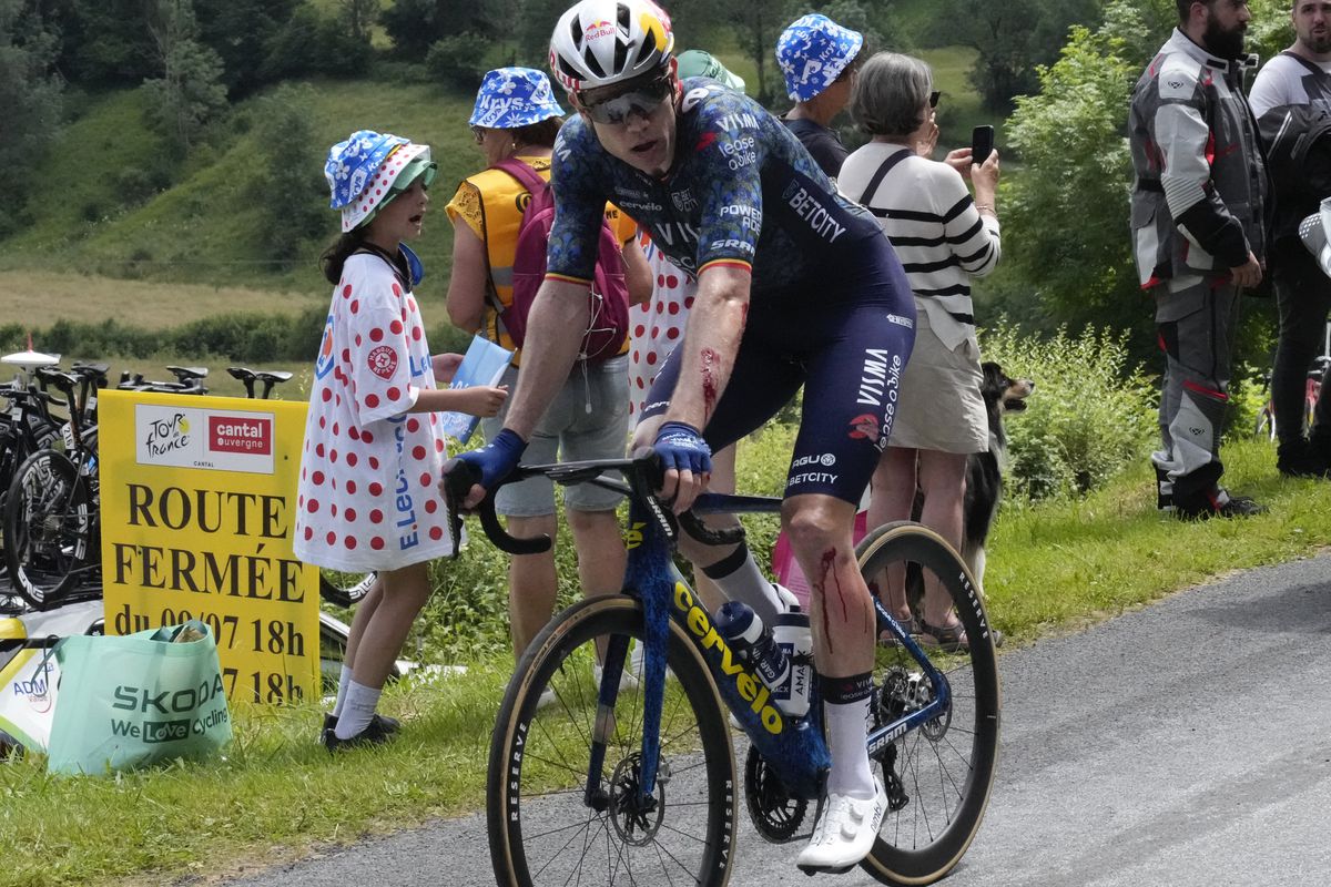 Flinke snijwond Wout van Aert na harde valpartij in de Tour: 'Ik heb er veel pijn aan'