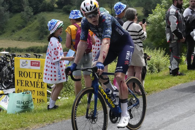 Flinke snijwond Wout van Aert na harde valpartij in de Tour: 'Ik heb er veel pijn aan'