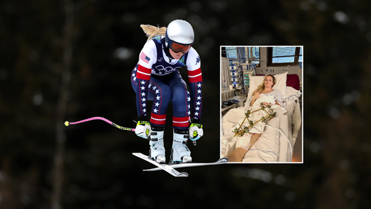 Arts na zien ziekenhuisfoto skilegende Lindsey Vonn (41): 'Het eerste doel is amputatie voorkomen'