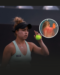 Tennisster ondervindt pijnlijke gevolgen van onoplettendheid in aanloop naar Australian Open: 'Dit is geen grap'