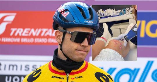 Wout van Aert toont nog altijd gehavende knie: 'Het is een soort schoonheidsbehandeling'