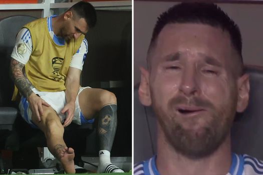 Zo ziet de enkel van Lionel Messi eruit na de finale van de Copa América, en dat is niet best