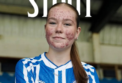 Voetbalster (16) die mikpunt van haat werd om haar uiterlijk, beleeft onwijs geluk bij debuut