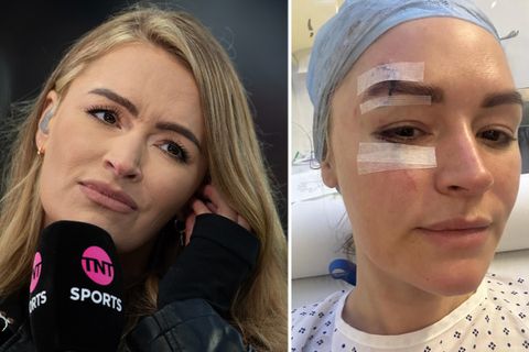 Bizar ongeluk levert presentatrice Laura Woods talloze hechtingen in gezicht op: 'Ik was doodsbang'