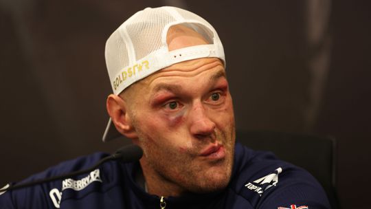 Bokser Tyson Fury gooit twee dagen nadat hij 100 miljoen verdiende thuis de vuilniszakken weg