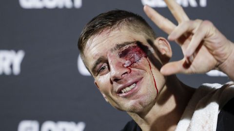 Rico Verhoeven na het gevecht met Jamal Ben Saddik © Getty Images
