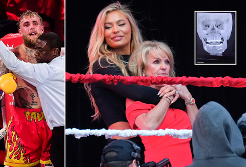 Schoonmoeder Jutta Leerdam deelt opmerkelijke kijk op pijnlijke gevolgen gevecht Jake Paul