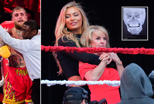 Schoonmoeder Jutta Leerdam deelt opmerkelijke kijk op pijnlijke gevolgen gevecht Jake Paul