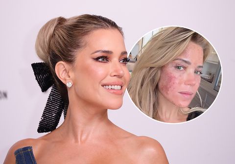 Sylvie Meis (ex Rafael van der Vaart) gewaarschuwd door arts voor 'intense' ingreep: 'Was het het waard?'