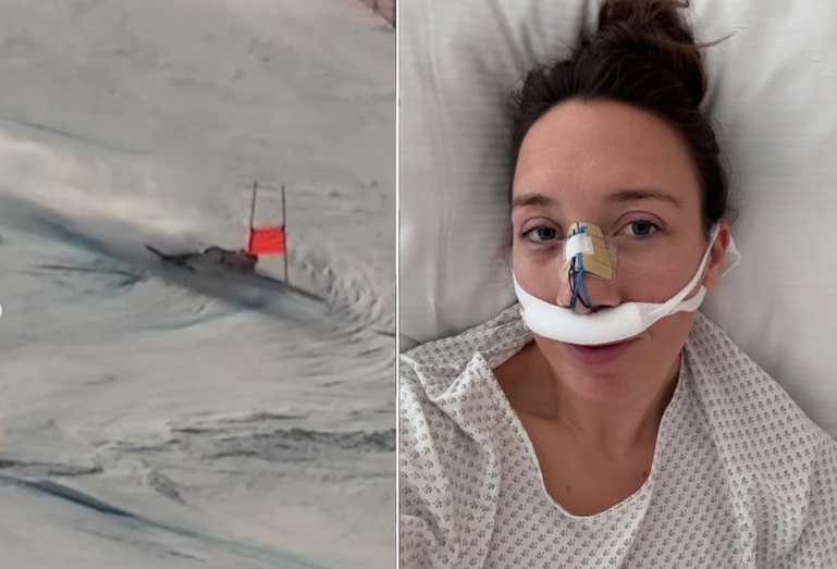Olympisch skiester deelt heftige beelden zware crash én de pijnlijke gevolgen