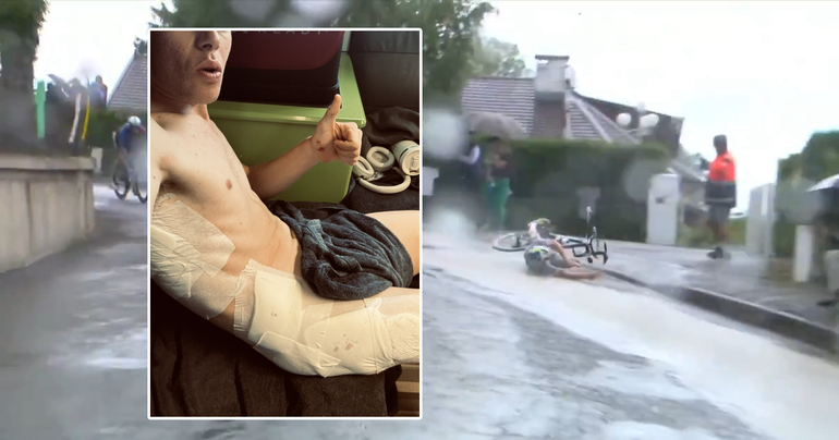 Spaanse pechvogel toont akelige gevolgen van afschuwelijke valpartij in Tour de France: 'Dat is ook fietsen'