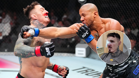 UFC-ster laat schade zien na 'illegaal' titelgevecht: 'Ik voelde hoe diep het ging'